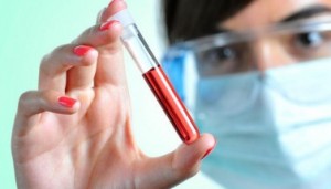 Как быстро понизить билирубин в крови в домашних условиях народными средствами