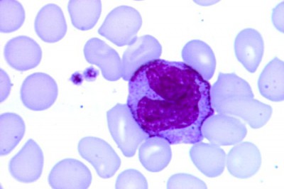Что такое моноциты в крови у ребенка норма таблица thumbnail